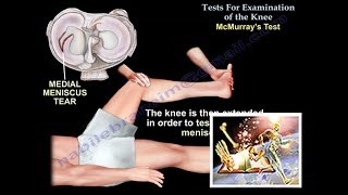 Tests For Examination Of The Knee  Everything You Need To Know  Dr Nabil Ebraheim [upl. by Bellaude]