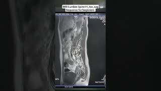 MRI Scan Showing Lumber Spine t1tsesag Sequence Planning for beginners beginners anatomy [upl. by Randolph]