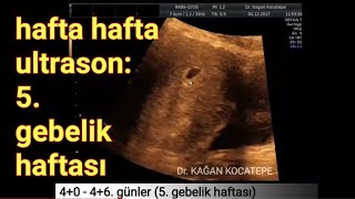 5 gebelik haftasında anne karnındaki bebek  Gebelik kesesi ve organlar oluşmaya başladı [upl. by Snowber]