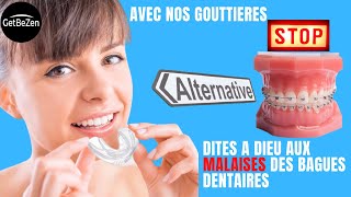 Gouttière dentaire pour alignement des dentsjoli sourire avec GetBeZen [upl. by Juliette]