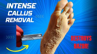 CALLUS REMOVAL [upl. by Attenna]