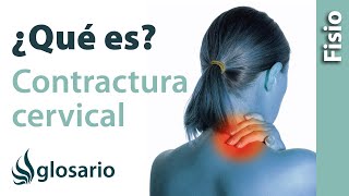 CONTRACTURA CERVICAL  ¿Qué es [upl. by Lrat750]