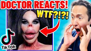 Plastic Surgeon Reacts to BOTCHED Plastic Surgery TikTok Videos [upl. by Adoh]