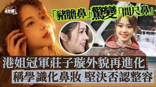 「豬膽鼻」離奇消失！TVB港姐冠軍惹整容疑雲，堅稱只是化鼻妝 [upl. by Jandel397]