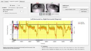 Fast Nystagmus Gazelab [upl. by Silera]