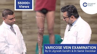 Varicose Vein Examination Dr Jignesh Gandhi and Dr Samir Deolekar [upl. by Wallinga]