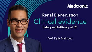 Safety and efficacy of RF renal denervation video [upl. by Arte]