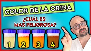 ¿Qué SIGNIFICA el COLOR de tu ORINA  ¿Cuál INDICA enfermedad GRAVE [upl. by Rabma]