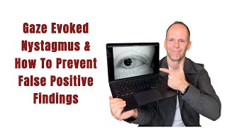 Gaze Evoked Nystagmus amp How To Prevent False Positive Findings [upl. by Benedick]