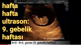 9 gebelik haftasında anne karnındaki bebek  açıklamalı ultrason görüntüleri [upl. by Kaitlyn]