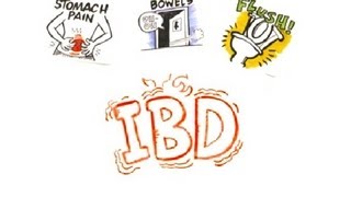 Inflammatory Bowel Disease IBD [upl. by Aseret812]