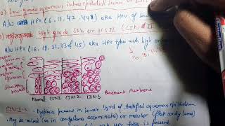 Cervical Intraepithelial Neoplasia CIN Pathology [upl. by Anuahs]