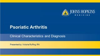 Psoriatic Arthritis  Clinical Characteristics and Diagnosis [upl. by Suidaht]