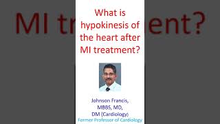 What is hypokinesis of the heart after MI treatment [upl. by Weed]