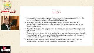 Pulmonary Lymphangitis Carcinomatosis [upl. by Ennaylil]