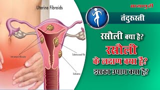 Uterine Fibroid Symptoms Precautions amp Treatment  Rasoli ka Ilaj in Hindi ft Dr Mangla Dogra [upl. by Fakieh307]