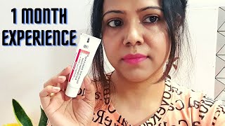 My 1 Month Experience with Demelan Cream  Honest Review [upl. by Nek]