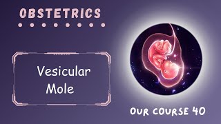 Rev Vesicular Mole  Page 4750  Obstetrics Module 40 [upl. by Massiw]