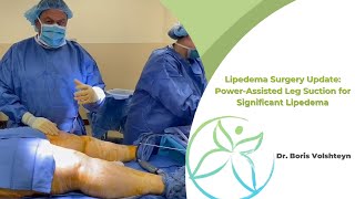 Lipedema Surgery Update PowerAssisted Leg Suction for Significant Lipedema  Dr Boris Volshteyn [upl. by Valeta]