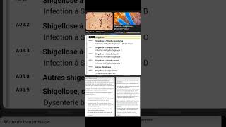 A03 Shigellose [upl. by Marbut]