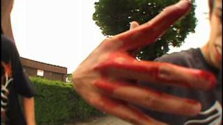 Skateboarding accidents falls crashes bails and pain Compilation [upl. by Annairoc468]