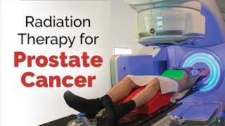 Radiation Therapy for Prostate Cancer [upl. by Merla]