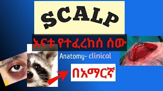 Scalp anatomy and clinical anatomy in amharic በአማርኛ [upl. by Ursas740]