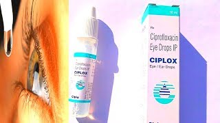 Ciplox 👂 Ear And 👁️ Eye Drop Review Bengali [upl. by Rooney578]