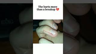 The hurts more than a breakup 💔funny heart nostalgia short viralshorts [upl. by Proudfoot319]