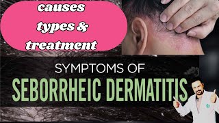 Seborrhic dermatitis and Dandruff symptoms causes and treatment [upl. by Ellegna54]