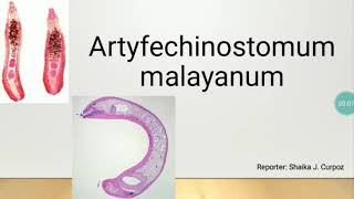 Artyfechinostomum Malayanum TREMATODE [upl. by Olinde]