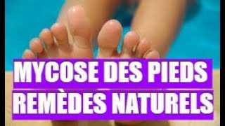 👉 MYCOSE DES PIEDS ★★★★★ REMÈDES NATURELS [upl. by Acnalb219]