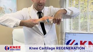 Knee Pain Treatment  Regenerate The Cartilage In Your Knee [upl. by Barrie]