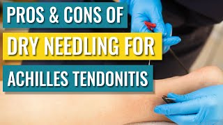 Dry Needling For Achilles Tendinopathy  Tendonitis — Does It Help [upl. by Htebaras593]