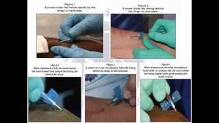 Vascular Access Cannulation Skills and Techniques [upl. by Leuamme610]