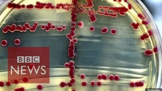 What is a superbug BBC News [upl. by Ayanej]