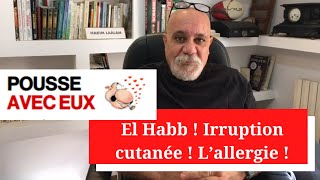 El Habb  Irruption cutanée  L’allergie [upl. by Clari]