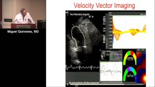 Regional Wall Motion amp Stress Echo Miguel Quinones MD December 6 2016 [upl. by Loni]