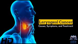 Laryngeal Cancer Silent Struggles and Hopeful Treatments [upl. by Odlanra]