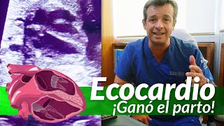 Ecocardiografía Fetal ¡Ganadora del parto [upl. by Eido]