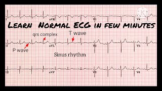 ECG test  ECG interpretation made easy  ECG report kaise dekhe  ECG reading  ECG dekhna sikhe [upl. by Julienne219]