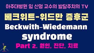 155 베크위트위드만 증후군 BeckwithWiedemann syndrome 2편 원인 진단 치료 [upl. by Anaed]