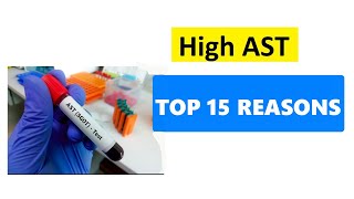 HIGH AST LEVELS  TOP 15 REASONS [upl. by Eliathan]