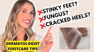 Footcare Tips for Cracked Heels Smelly Feet Toenail Fungus amp More  Dermatologist Dr Sam Ellis [upl. by Atilrahc847]