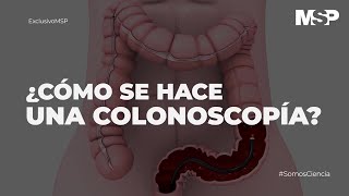 ¿Cómo se hace una colonoscopía ExclusivoMSP [upl. by Anrak459]