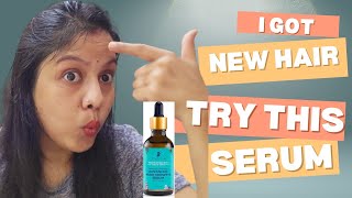 best hair growth Serum for faster hair growth amp control hairfall Pilgrim hair growth Serum review [upl. by Ameehs]