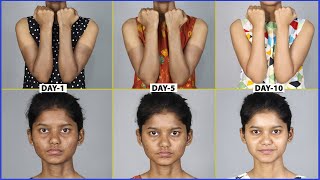 Remove TANNING in 10 Days NATURALLY  Remove HAND amp FACE TAN Using Natural Remedies  Prevention [upl. by Ahseikram]