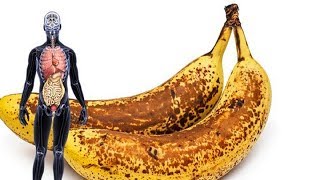 5 Beschwerden bei denen Bananen besser als Arzneimittel helfen [upl. by Gabrila207]