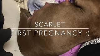 Scarlets first pregnancy  pit bull birth [upl. by Bleier941]