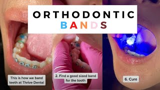 Orthodontist Explains How to band teeth Banding braces shorts [upl. by Gildea]